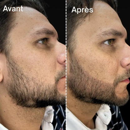 MagicBeard™ - Bâton remplissage de barbe