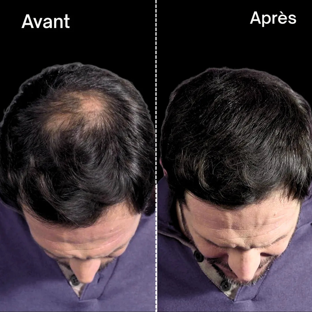 MagicHair™ - Poudre de teinture