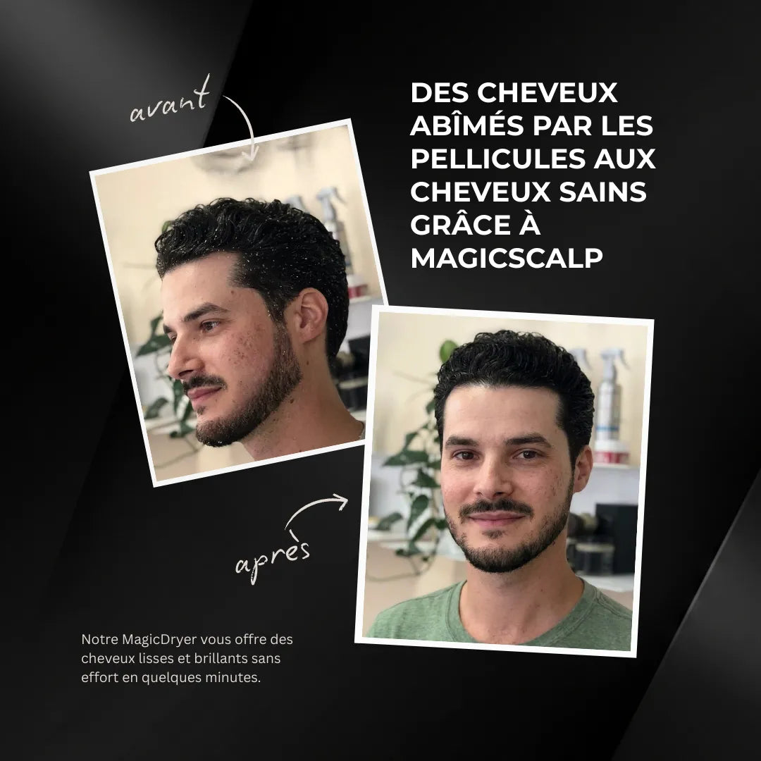 MagicScalp™ - Brosse nettoyante