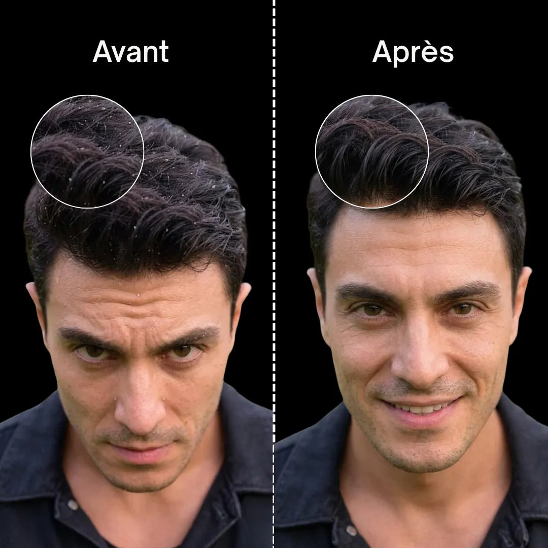 MagicScalp™ - Brosse nettoyante