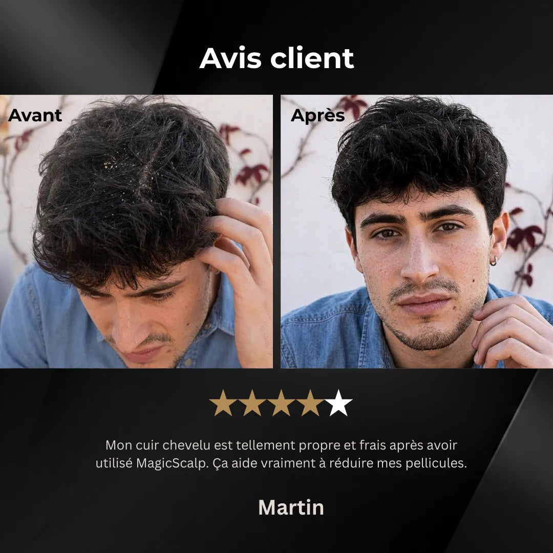 MagicScalp™ - Brosse nettoyante