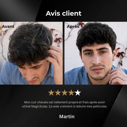 MagicScalp™ - Brosse nettoyante